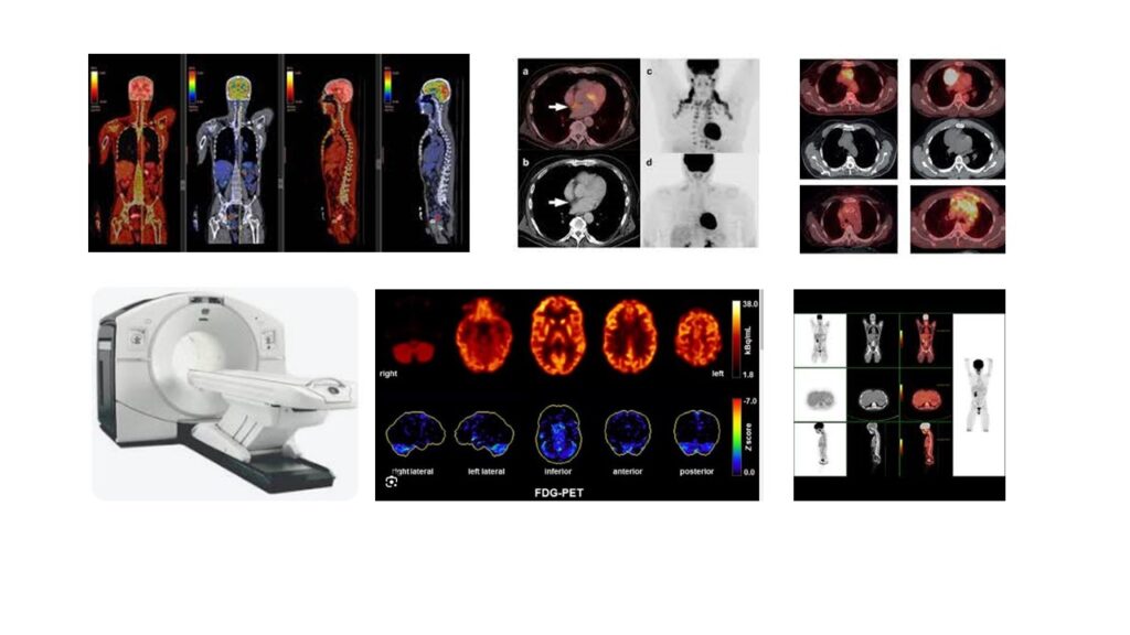 pet ct scan in delhi